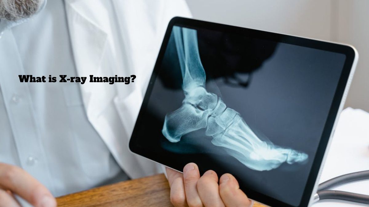 What is X-ray Imaging?